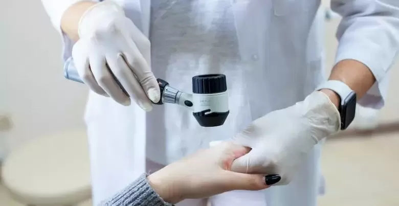 Paciente con verrugas sometido a exame diagnóstico por un dermatólogo